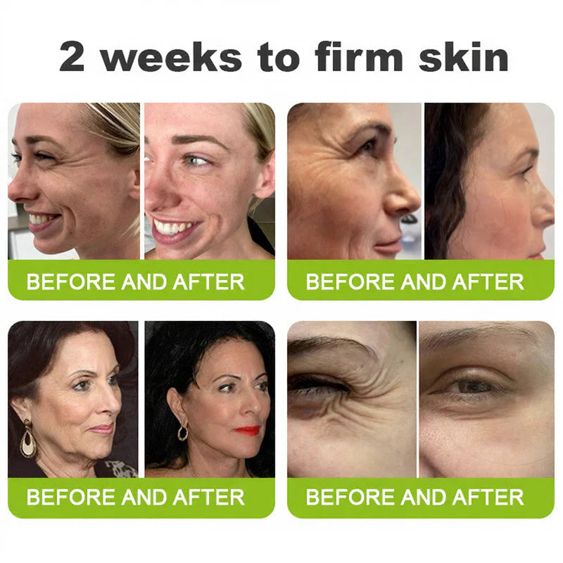 Made and shipped from the USA 💫ZyliaCo  Skin Tightening & Vita-A Retinol Retinol shot Anti-Wrinkle Firming Tightening cream - Last Day Promotion 50% OFF