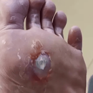 Foot care product benefit